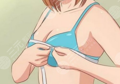 上海東方醫(yī)院隆胸好嗎