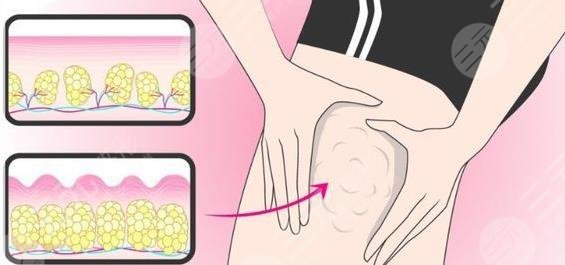 大腿
