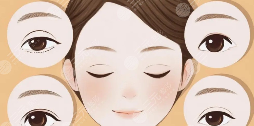 雙眼皮