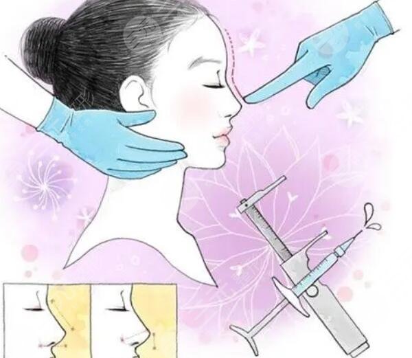 隆鼻