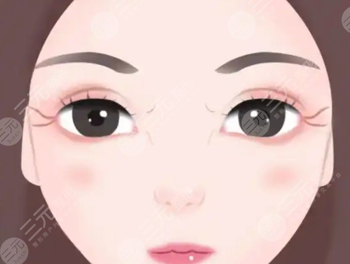 雙眼皮