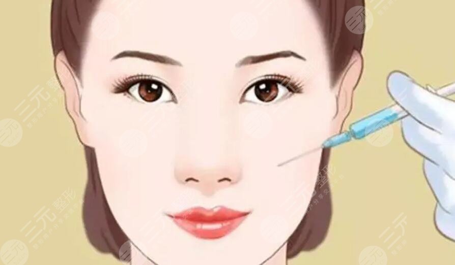 蘋(píng)果肌