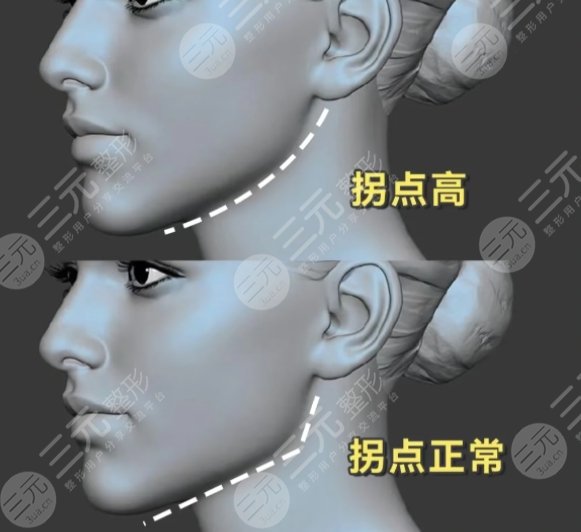 下頜角