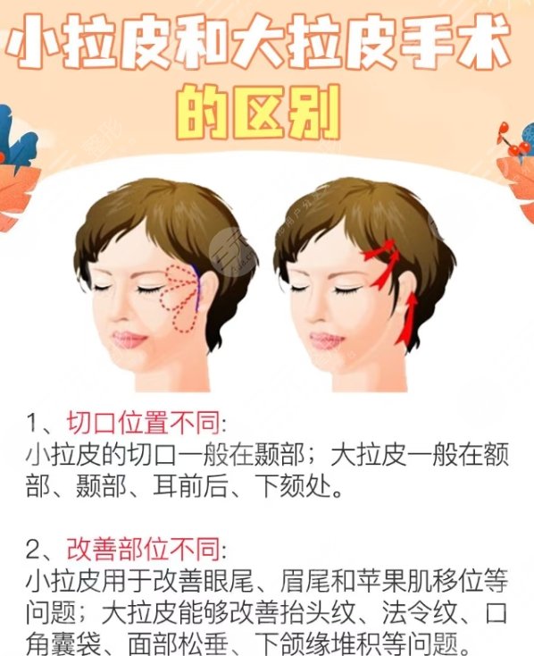 拉皮