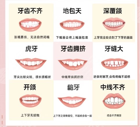 牙齒矯正