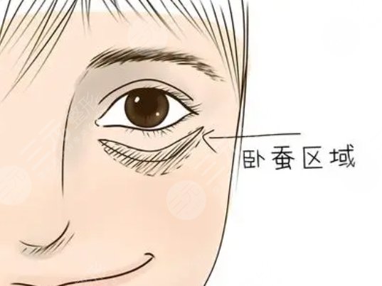 臥蠶
