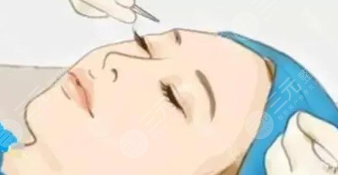雙眼皮