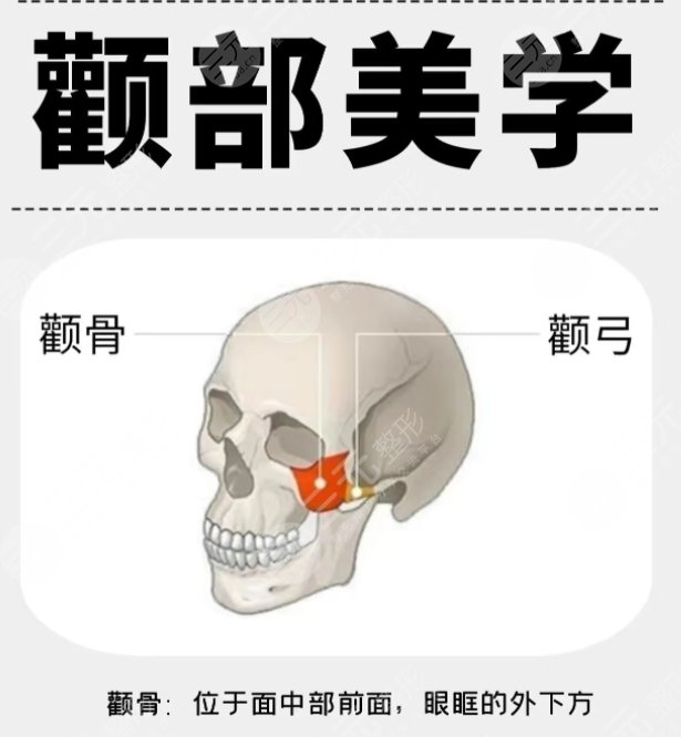 顴骨