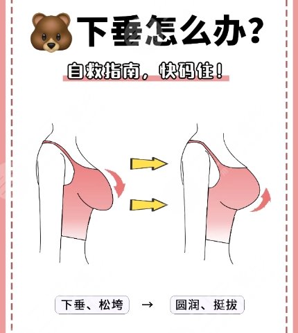 下垂