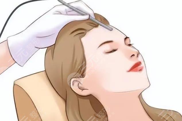 激光