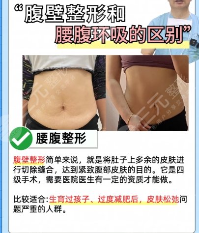 吸脂