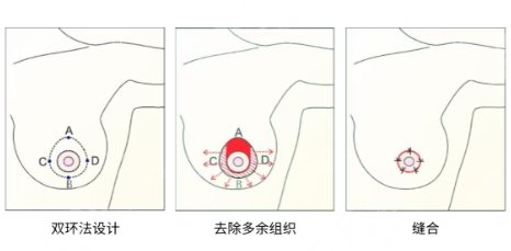 縮胸