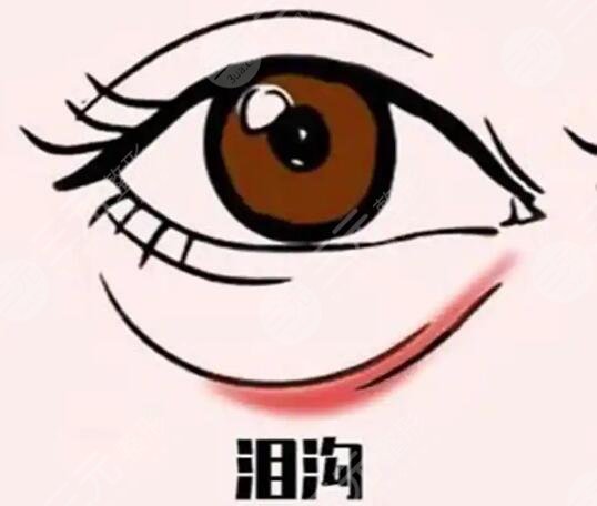 淚溝
