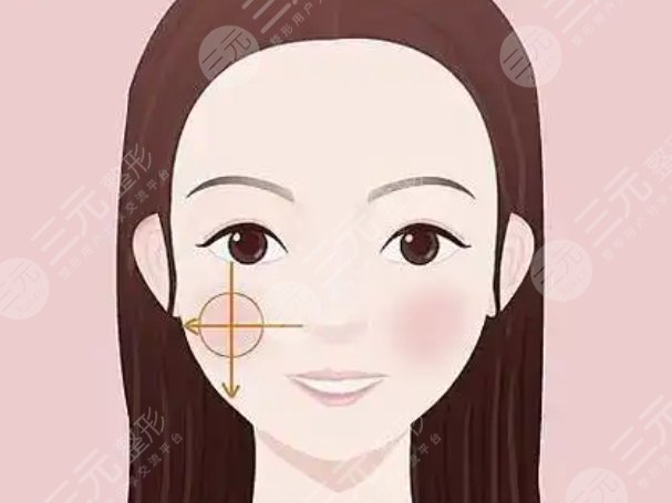 蘋(píng)果肌