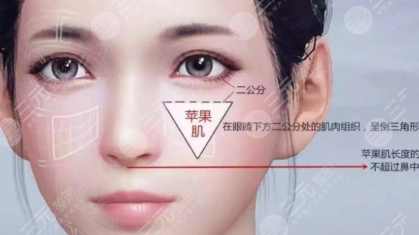 蘋果肌
