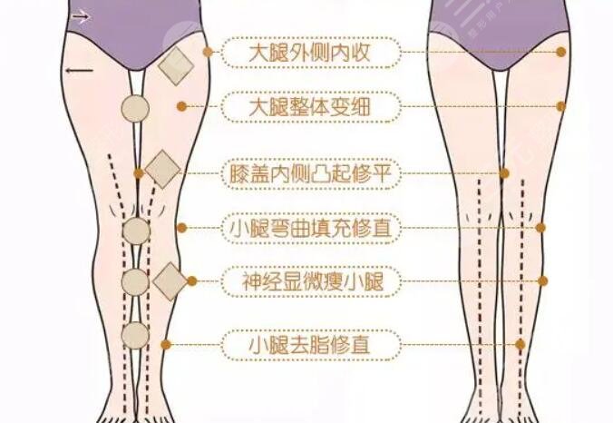 直腿