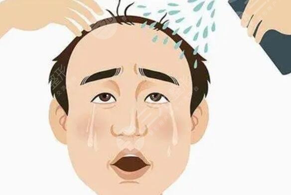 植發(fā)