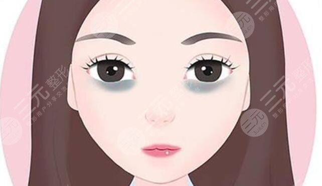 黑眼圈