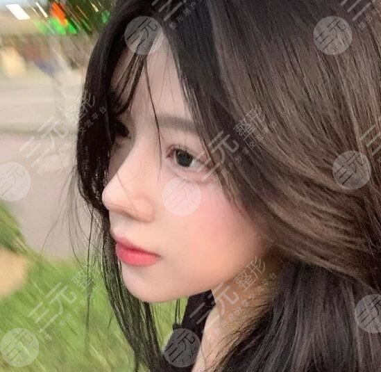 隆鼻
