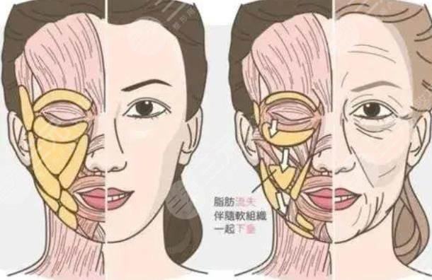抗衰
