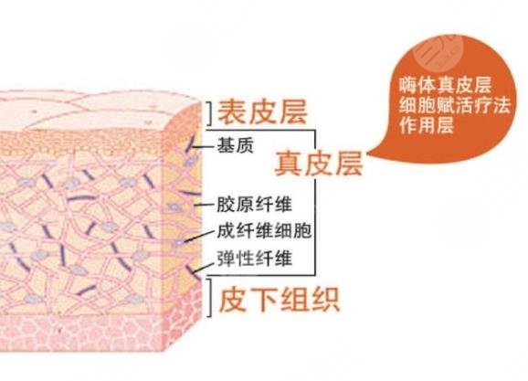嗨體