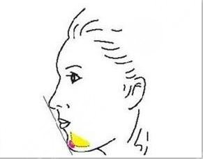 玻尿酸 