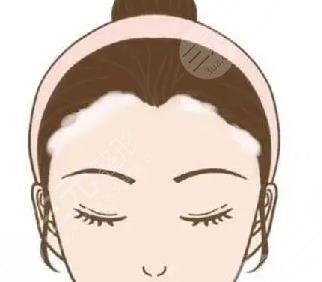 發(fā)際線