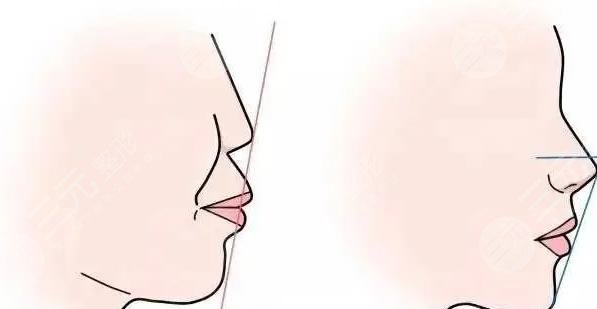 正頜