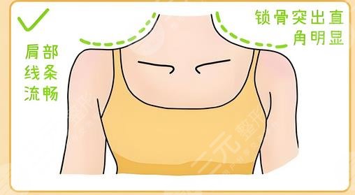 直角肩