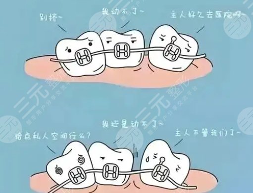 牙齒矯正