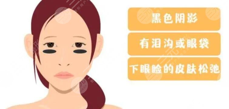 黑眼圈