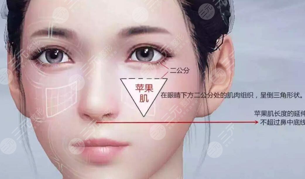 蘋果肌