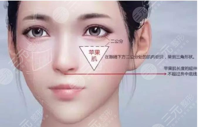 蘋果肌