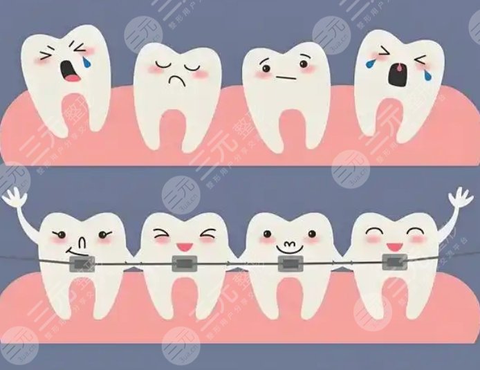 牙齒矯正