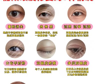 雙眼皮